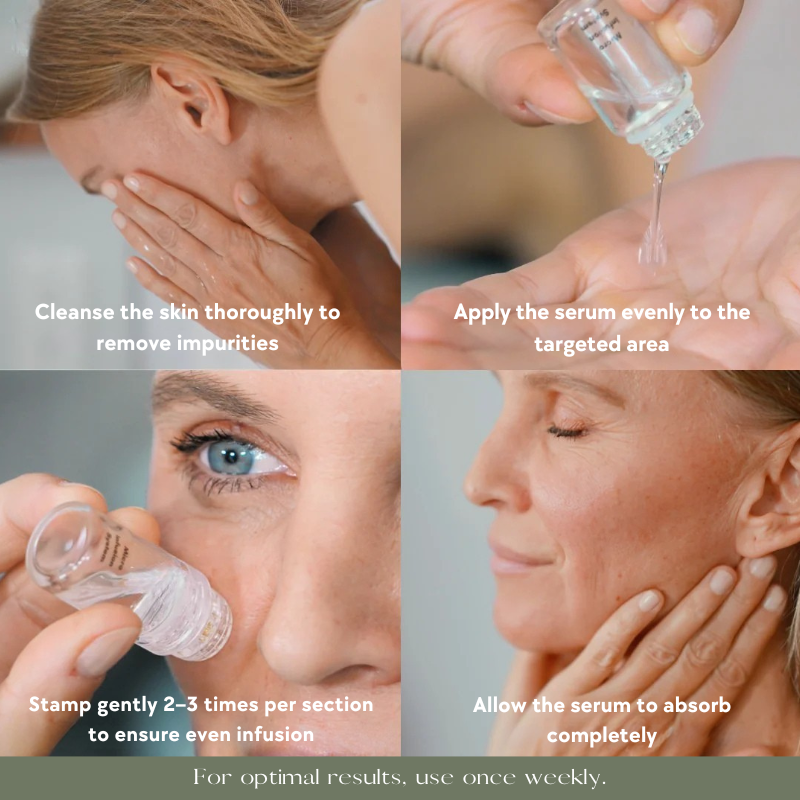 Skin Logic™ Micro Infusion System